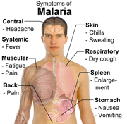 Malariasymptoms