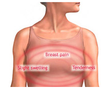 Breast Pain