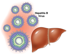 Hepatitis