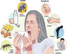 allergies-cause